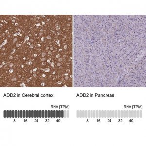 Anti-ADD2 antibody produced in rabbit 