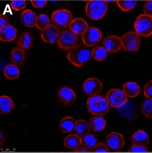 Anti-Adenovirus Hexon Antibody, clone 7/48.7c ZooMAb Mouse Monoclonal 