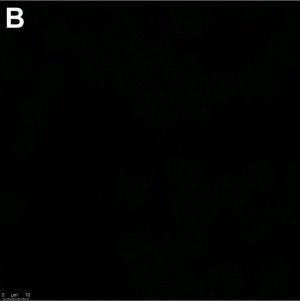 Anti-Adenovirus Hexon Antibody, clone 7/48.7c ZooMAb Mouse Monoclonal 