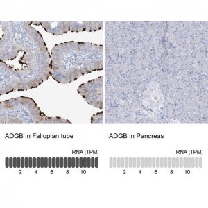Anti-ADGB antibody produced in rabbit 