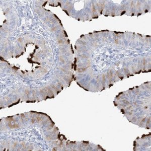 Anti-ADGB antibody produced in rabbit 