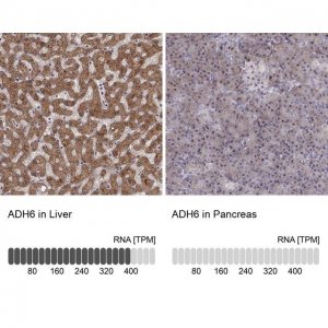 Anti-ADH6 
