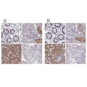 Anti-ADH6 