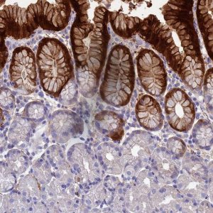 Anti-ADH7 antibody produced in rabbit 