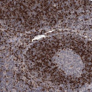 Anti-ADK antibody produced in rabbit 