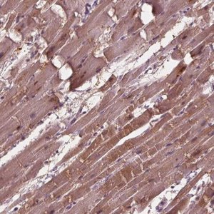 Anti-ADPRHL1 antibody produced in rabbit HPA066478-100UL
