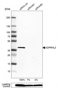 Anti-ADPRHL2 antibody produced in rabbit 