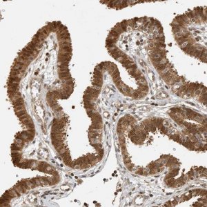 Anti-ADPRHL2 antibody produced in rabbit 