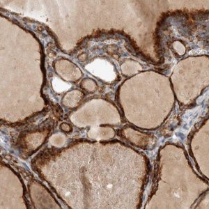 Anti-ADPRM antibody produced in rabbit 