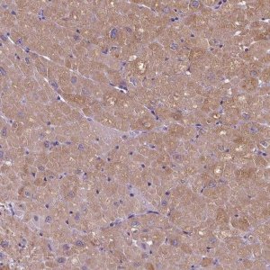 Anti-ADRB1 antibody produced in rabbit 