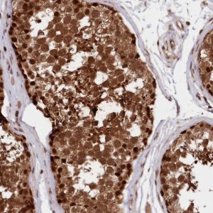 Anti-ADRM1 antibody produced in rabbit 