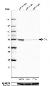 Anti-ADSL antibody produced in rabbit 