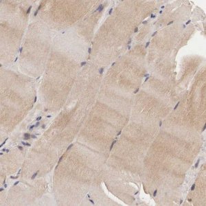 Anti-ADSL antibody produced in rabbit 