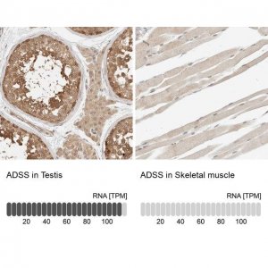 Anti-ADSS antibody produced in rabbit 