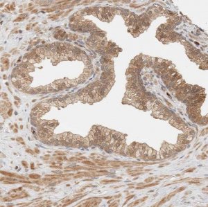 Anti-ADSS antibody produced in rabbit 