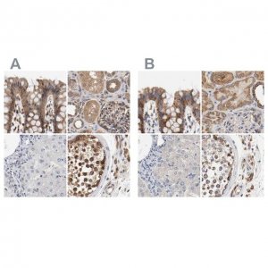 Anti-AFG3L2 antibody produced in rabbit 