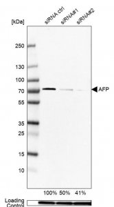 Anti-AFP antibody produced in rabbit 