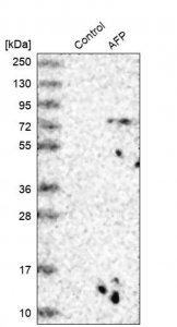 Anti-AFP antibody produced in rabbit 