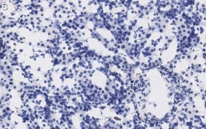 Anti-AFP Antibody, clone 3B7 ZooMAb Rabbit Monoclonal 