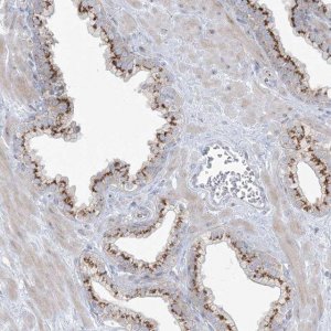 Anti-AFTPH antibody produced in rabbit 