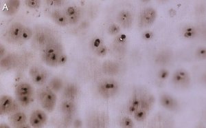 Anti-Aggrecan Antibody, clone 4B10 ZooMAb Rabbit Monoclonal 