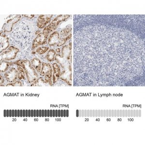 Anti-AGMAT antibody produced in rabbit 