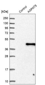 Anti-AGPAT5 antibody produced in rabbit HPA010950-100UL