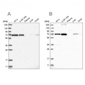 Anti-AGPS antibody produced in rabbit 