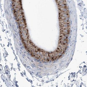 Anti-AGPS antibody produced in rabbit 