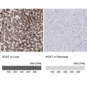 Anti-AGXT antibody produced in rabbit 