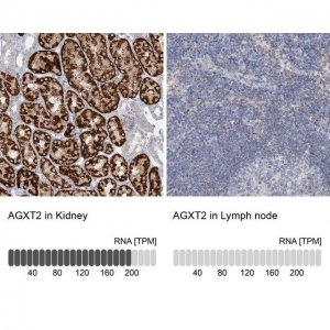 Anti-AGXT2 antibody produced in rabbit 