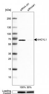 Anti-AHCYL1 antibody produced in rabbit HPA042589-100UL
