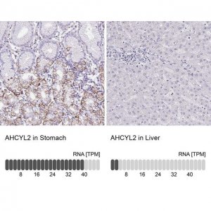 Anti-AHCYL2 antibody produced in rabbit 