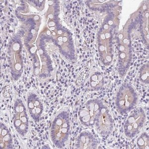 Anti-AHCYL2 antibody produced in rabbit 
