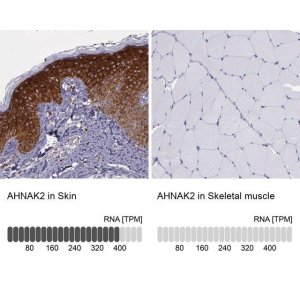 Anti-AHNAK2 antibody produced in rabbit 