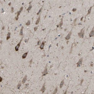 Anti-AIMP1 antibody produced in rabbit HPA018476-100UL