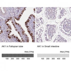 Anti-AK1 antibody produced in rabbit 