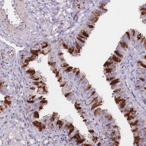 Anti-AK1 antibody produced in rabbit 
