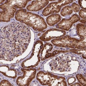 Anti-AK3 antibody produced in rabbit 