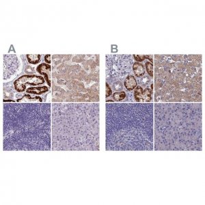 Anti-AK4 antibody produced in rabbit 