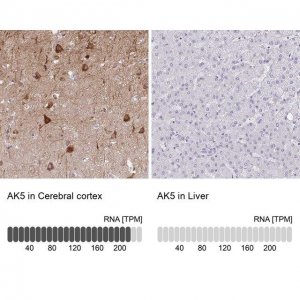 Anti-AK5 antibody produced in rabbit 