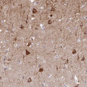Anti-AK5 antibody produced in rabbit 