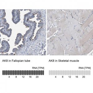 Anti-AK8 antibody produced in rabbit 