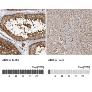 Anti-AK9 antibody produced in rabbit 