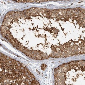Anti-AK9 antibody produced in rabbit 
