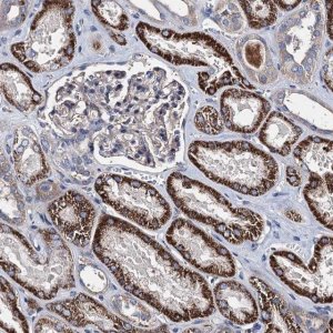 Anti-AKAP11 antibody produced in rabbit 