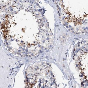 Anti-AKAP3 antibody produced in rabbit 