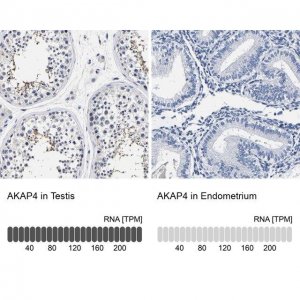 Anti-AKAP4 antibody produced in rabbit 