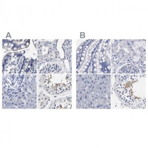 Anti-AKAP4 antibody produced in rabbit 