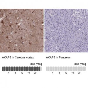 Anti-AKAP5 antibody produced in rabbit 